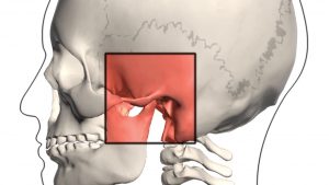 TMJ Treatment at Dental Partners of Boston