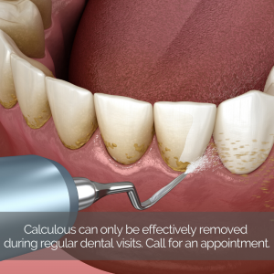 what causes tartar on my teeth