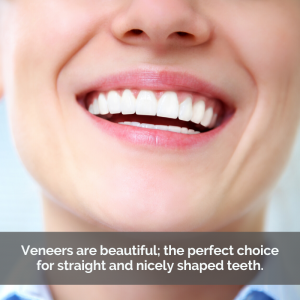 Woman smiling with dental veneers