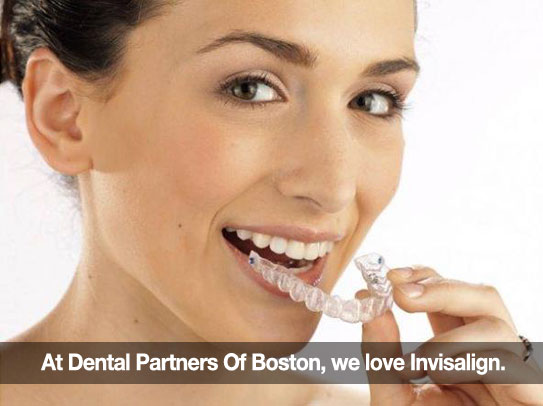 A woman putting Invisalign in her mouth