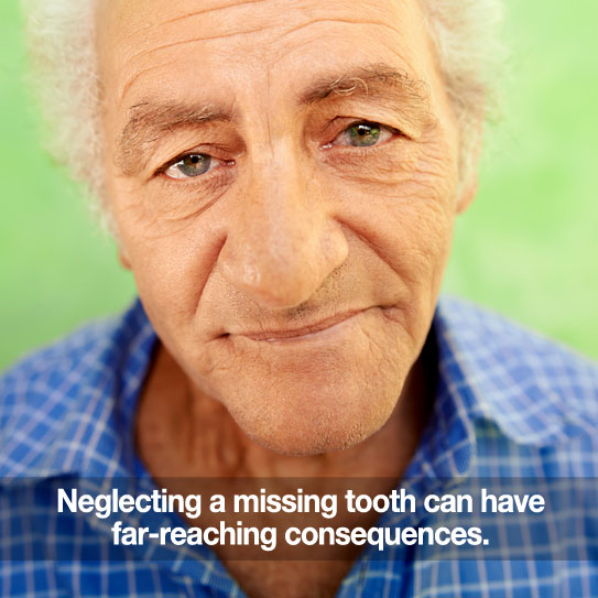 Elderly man with displease look. Caption: Neglecting a missing tooth can have far-reaching consequences