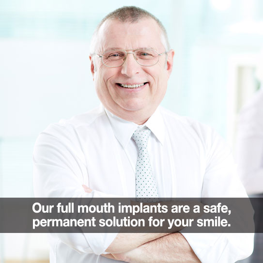 Man smiling. Caption: Our full mouth implants are a safe, permanent solution