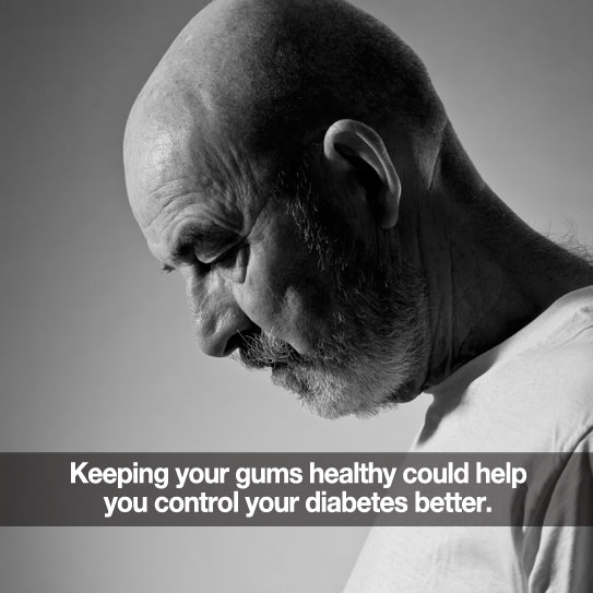 Bald man looking depressed. Caption: Keeping your gums healthy could help you control diabetes