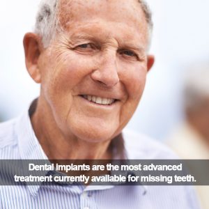 Senior man smiling. Caption: Dental implants are the most advanced treatment available.