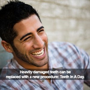 Man smiling. Caption: Heavily damaged teeth can be replaced with Teeth-In-A-Day