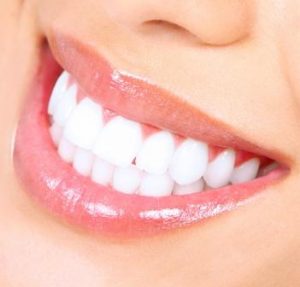 Close up of a woman's smile with perfect teeth. Dental Implants can bring you a new smile.