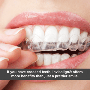 Close up of a woman putting on Invisalign® aligners