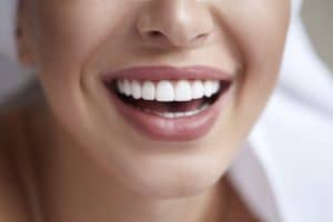 Teeth whitening systems at Dental Partners of Boston