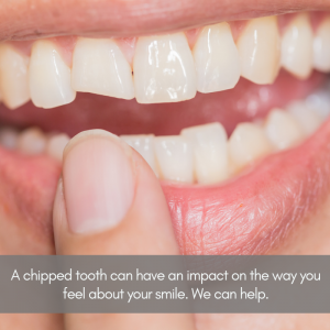 chipped tooth repair after - Wake Orthodontics & Pediatric Dentistry