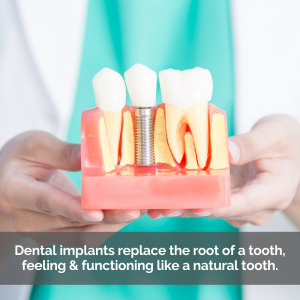Dental implant cross section model.