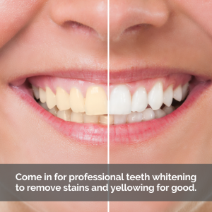 Caption: Come in for professional teeth whitening to remove stains and yellowing for good.