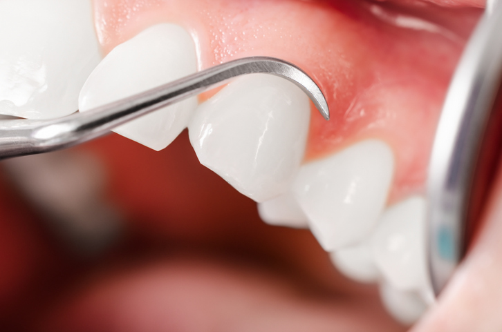 A periodontist is primarily concerned about the health of your gums.