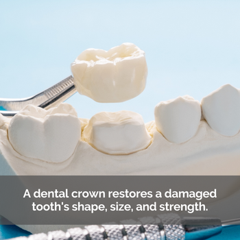 Dental crown on a mold of teeth