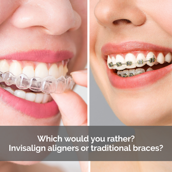 Split image of Invisalign and braces