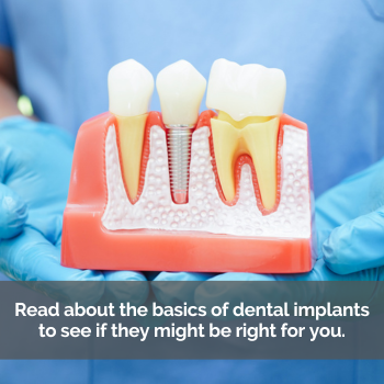 Dental implants model: Caption: read about the basics of dental implants. Are they right for you?