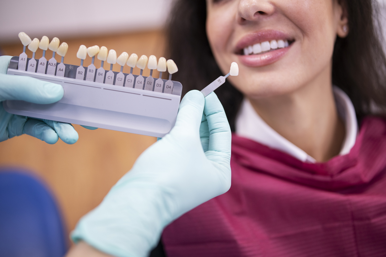 Dentist matching the right white tone for a dental veneers using a color swatch palette.